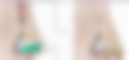 大连何医生鼻整形门诊部预约挂号指南