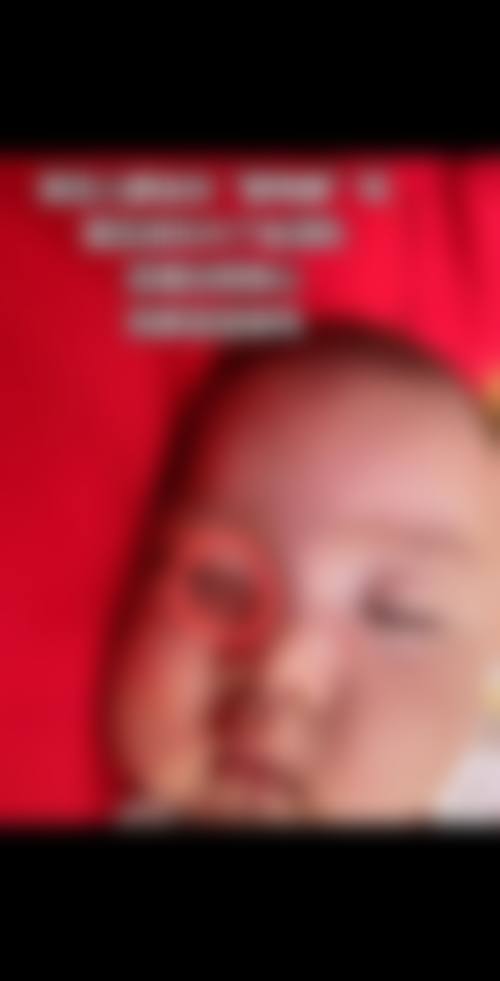 三、百色右江民族医学校附属医院烧伤整形外科核心技术与诊疗优势