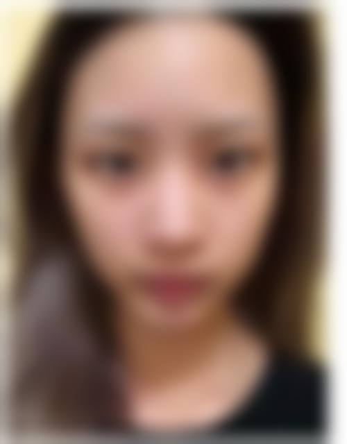 大连何医生鼻整形门诊部患者常见问题解答