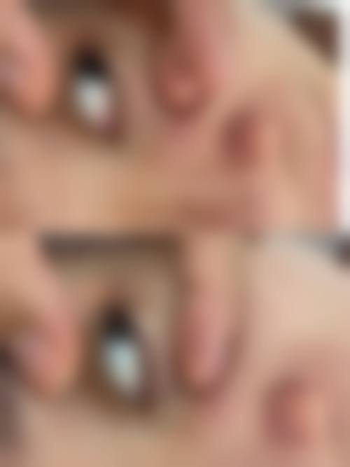 七、百色右江民族医学校附属医院烧伤整形外科常见问题解答