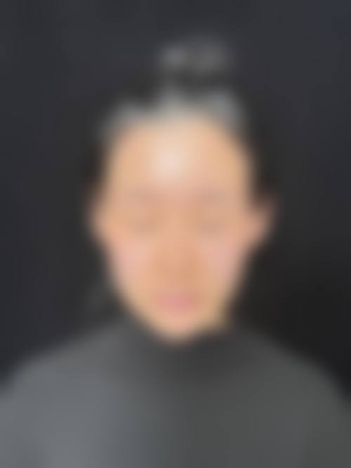 二、百色右江民族医学校附属医院烧伤整形外科重点开展项目