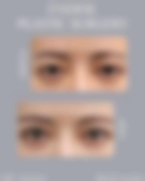 商丘睢阳唯美整形医院国有还是私立:性质解析