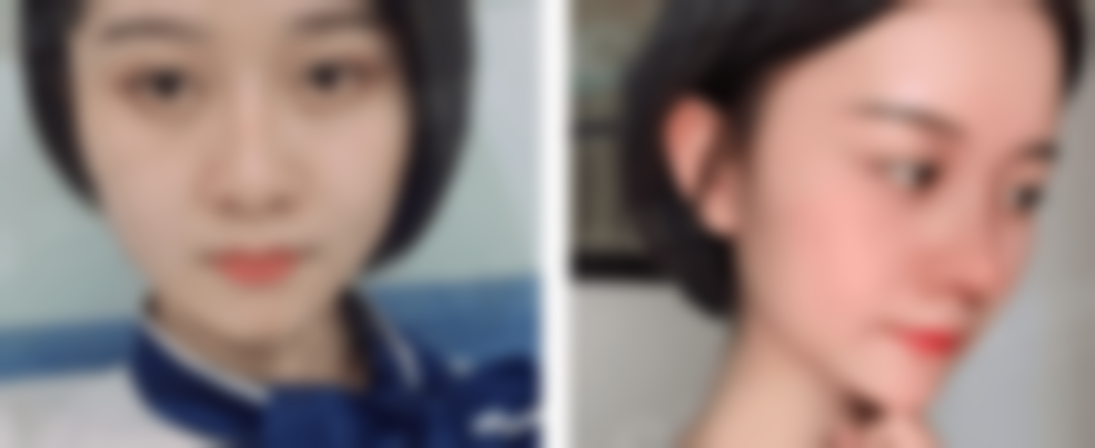 黄露萍医生擅长项目