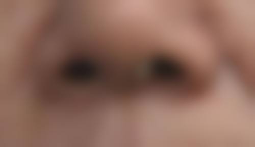 广州佳和医院血管瘤科医院特色技术及优质服务