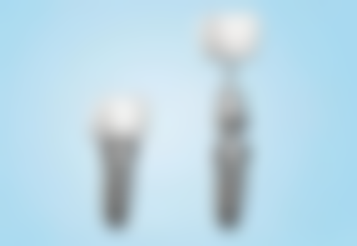 牙齿敏感修复时间受哪些因素影响