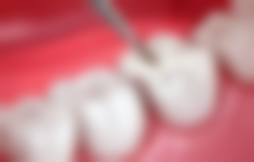 达州其他牙科医院推荐