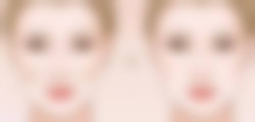 芮春昊医生技术优势