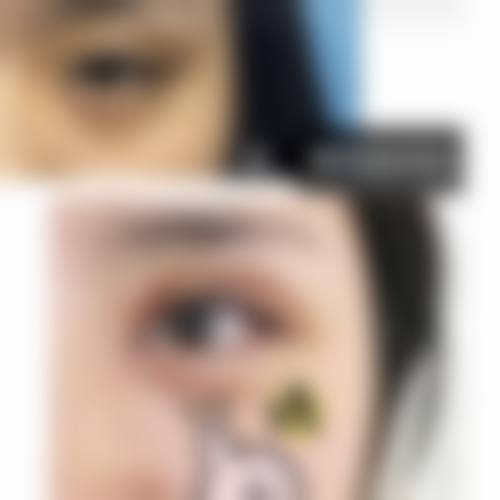 何泰源整形外科真人口碑评价怎么样？