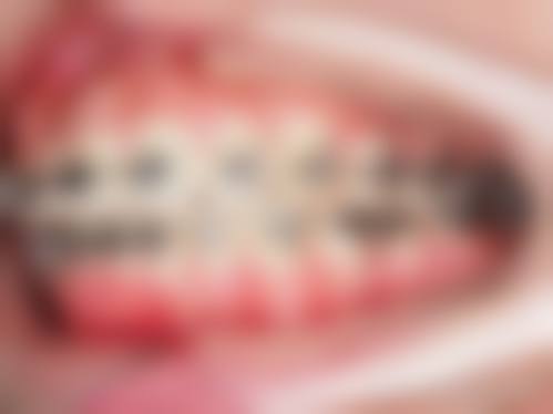 在线询问的重要性