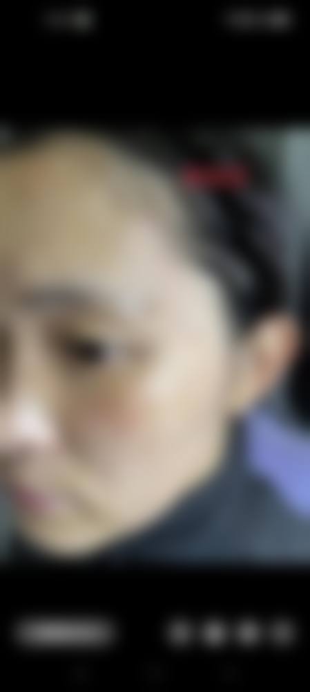 广州佳和医院血管瘤科是国有的吗？