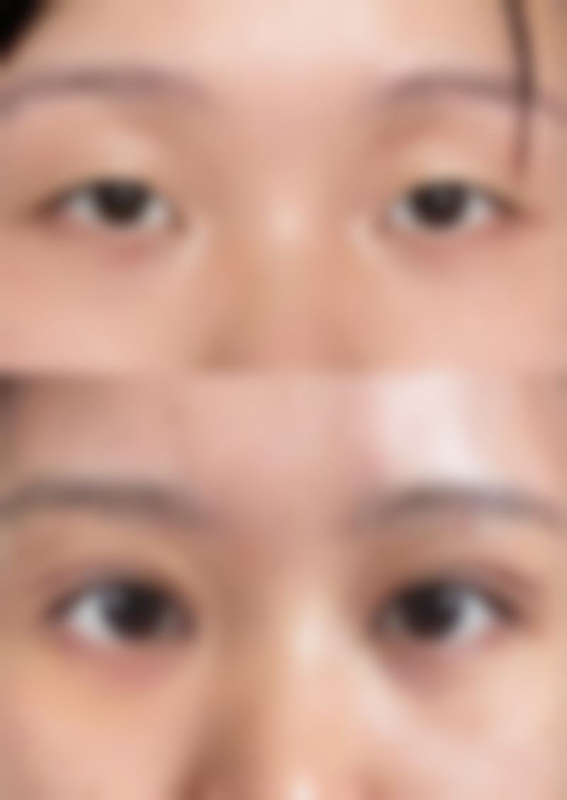 广州佳和医院血管瘤科预约挂号指南