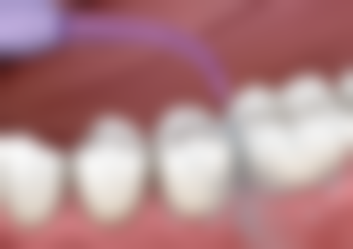 海盐牙齿矫正在线咨询24小时！嘉兴海盐圣禾口腔等多机构可选，金属托槽6800元 