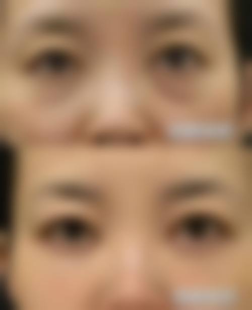 乌鲁木齐严代璟医疗美容收费价格表/收费标准