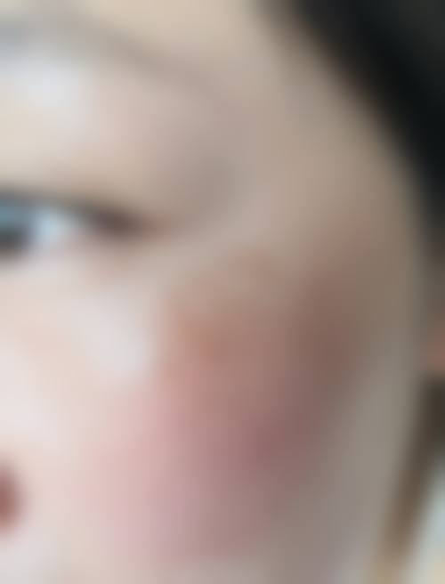 天津伊曼医疗美容门诊部患者常见问题解答