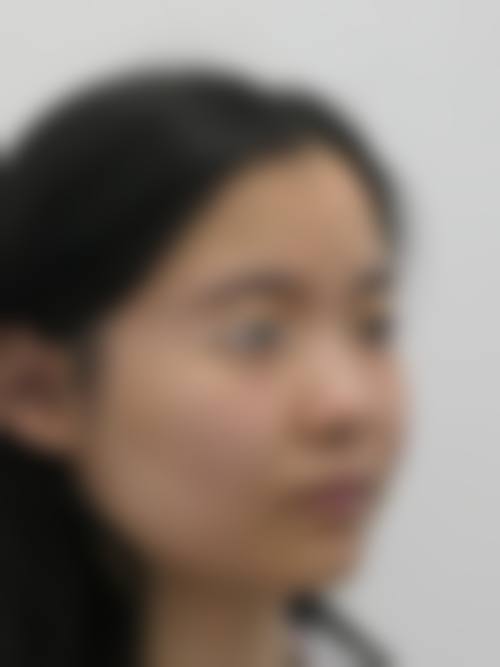 齐齐哈尔大千医疗美容诊所患者常见问题解答