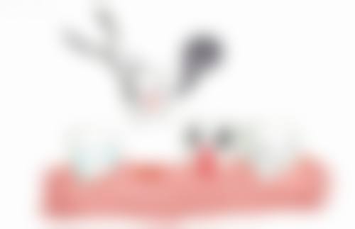 拔牙种植牙的术前检查和术后护理