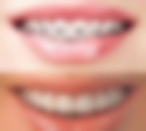 八、如何选择适合自己的陆良口腔诊所？