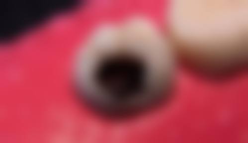 五、陆良景宸口腔综合看牙表现如何？