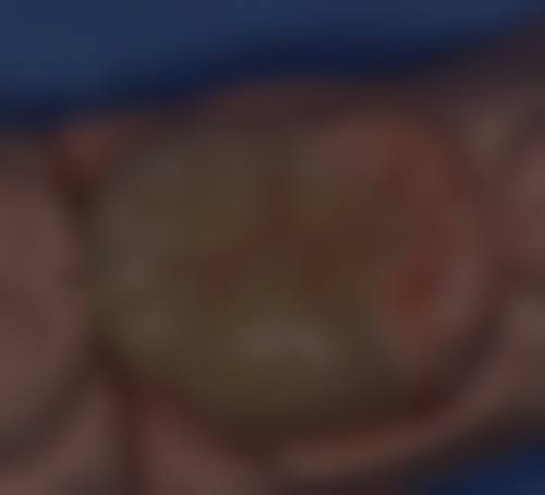 {嘉善补牙在线咨询24小时，靠谱！牙博士、金铂利等多机构可选，补牙200元起还有优惠 