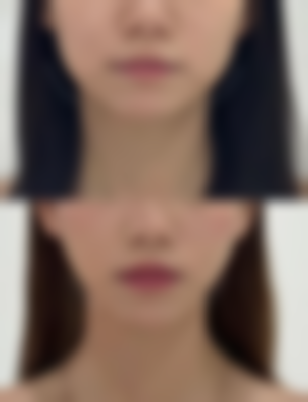 长沙简龄医疗美容诊所怎么样