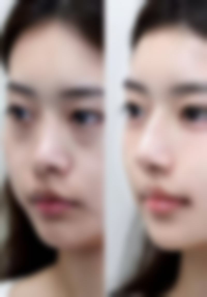 长沙简龄医疗美容诊所价格表