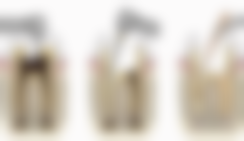 四、牙米口腔:数字化即种即修技术的领跑者