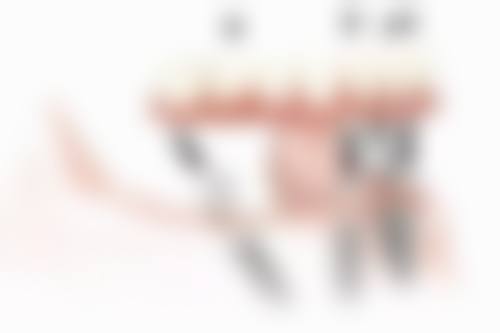 超过时间不做牙冠有啥后果