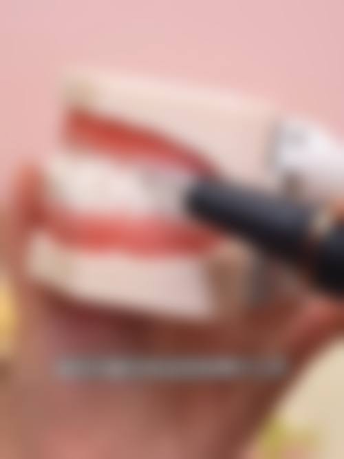 牙齿矫正项目价格