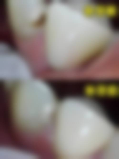 {铜陵牙齿矫正医院在线咨询24小时！渡江口腔靠谱，矫正5000起，还有多种口腔项目可选！ 