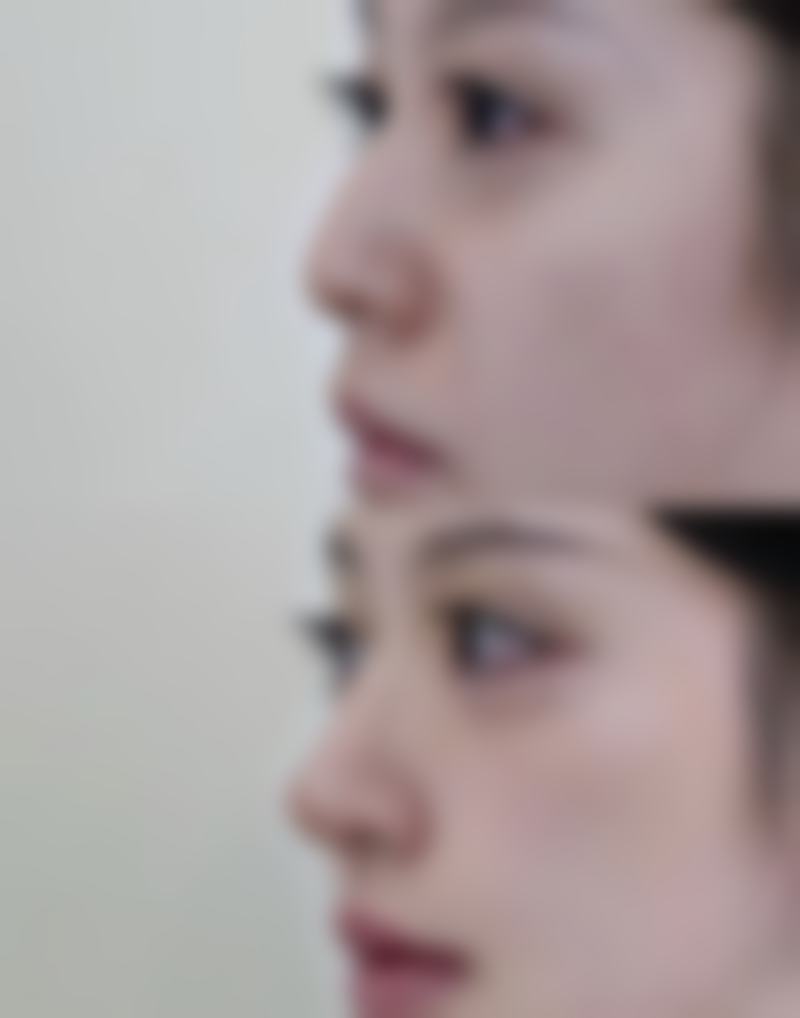 六、台州天南医疗美容诊所口碑好评反馈