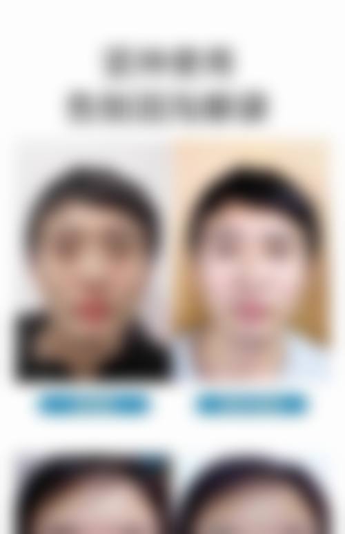 鞍山崔芳医疗美容诊所患者常见问题解答