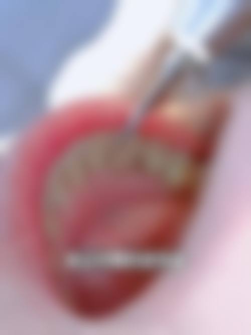 家庭美白套装：方便实用，日常维护之选