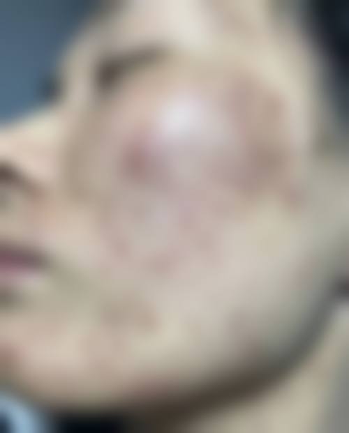 佳木斯铭源皇宫医疗美容门诊患者常见问题解答