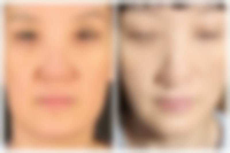 鞍山崔芳医疗美容诊所口碑如何？