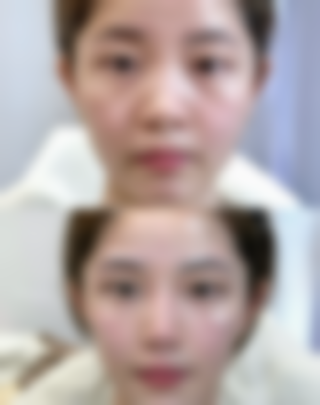 鞍山崔芳医疗美容诊所医院特色技术及优质服务