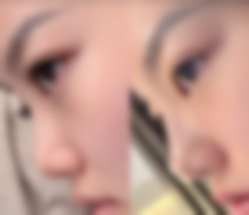 鞍山崔芳医疗美容诊所怎么样？