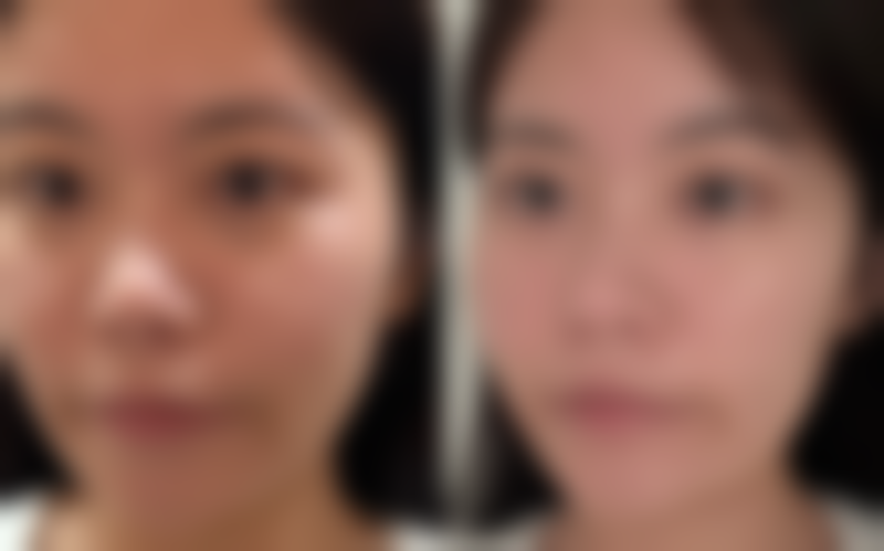 鞍山崔芳医疗美容诊所预约挂号指南