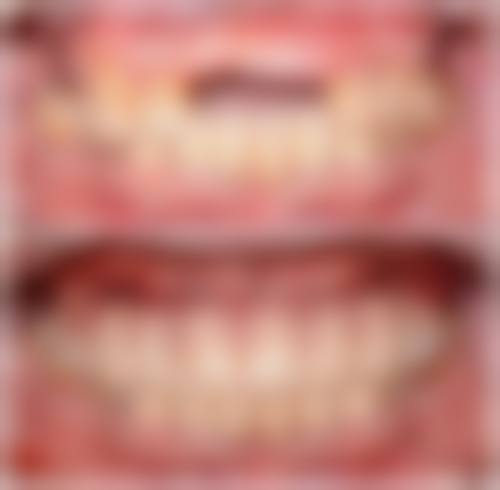 长治半口种植在线询问