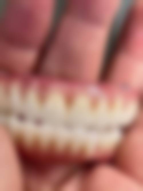 使用寿命：烤瓷牙和真牙谁更持久？