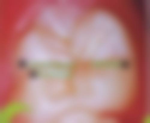 {广东拔牙在线咨询24小时，靠谱！多三甲医院医生坐诊，还有低价种牙福利等你享