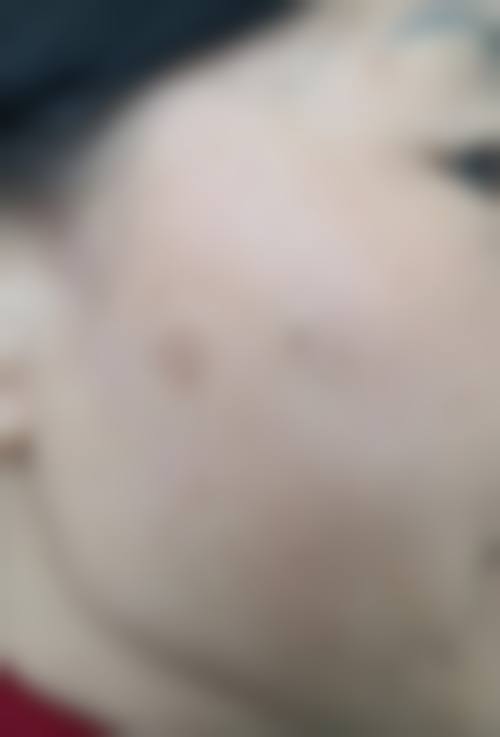 上饶美嘉医疗美容门诊部价目表