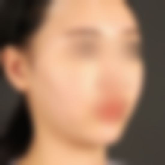 李昇燦医生预约挂号