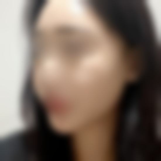 李昇燦医生技术优势