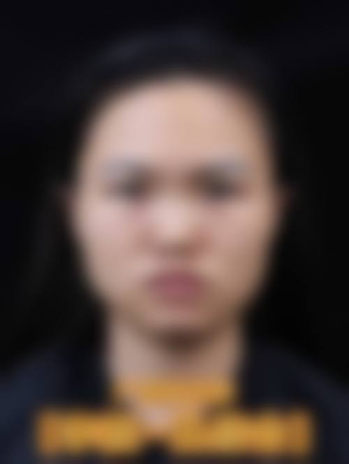 长沙素妍医疗美容医院真实实例