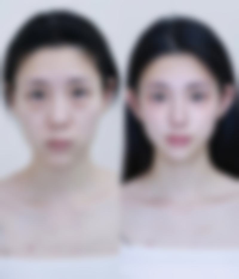 杨子伟医生擅长项目