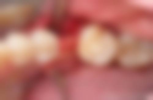 {珠海儿牙24小时在线咨询，六和口腔专业儿牙医生坐诊，可解决早矫等儿童牙病问题