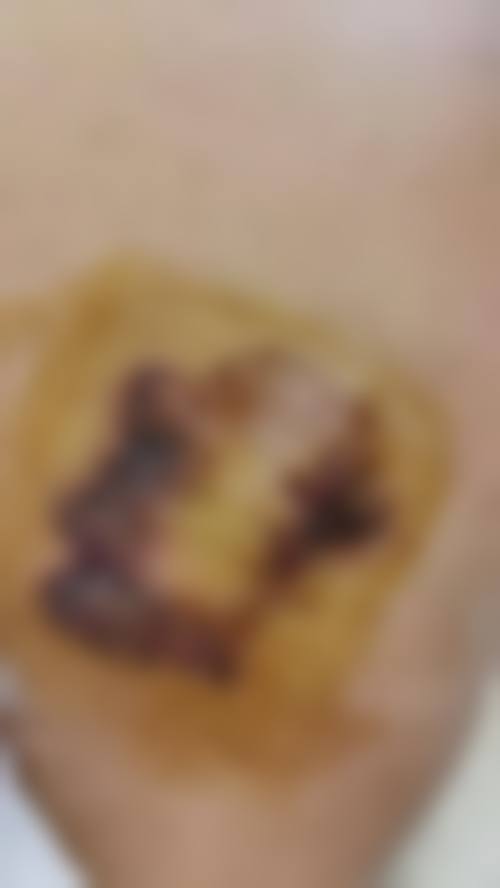 济南新颜整形医院真实实例