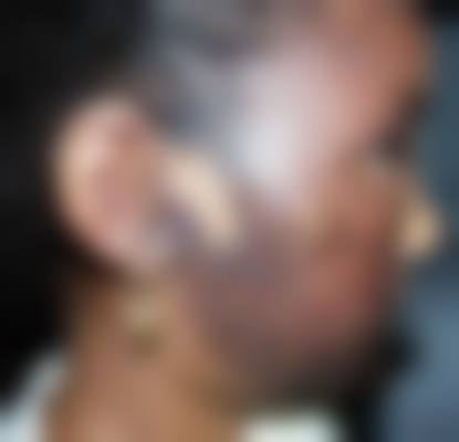 济南新颜整形医院价目表