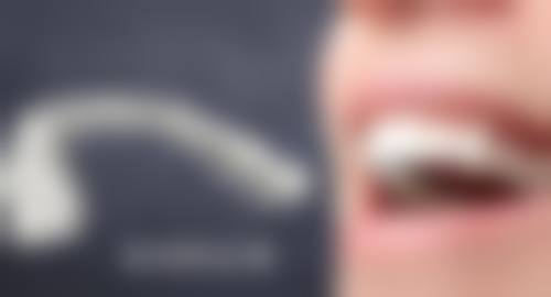 {山西金属矫正24小时在线咨询，解答正畸各类疑问，预估9800元起费用，推荐本地靠谱牙医