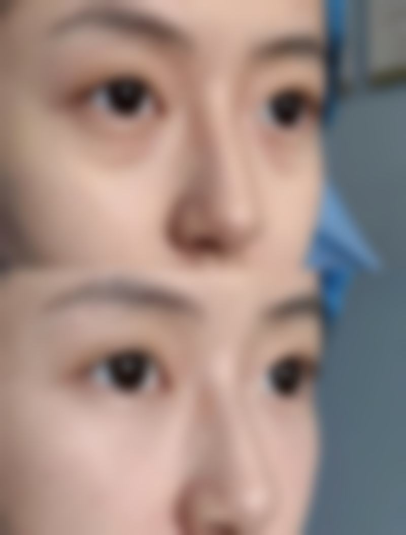 榆林朝阳医院整形美容科怎么样?